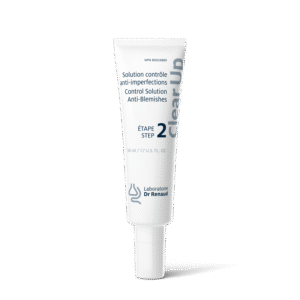 Solution contrôle anti-imperfections Étape 2